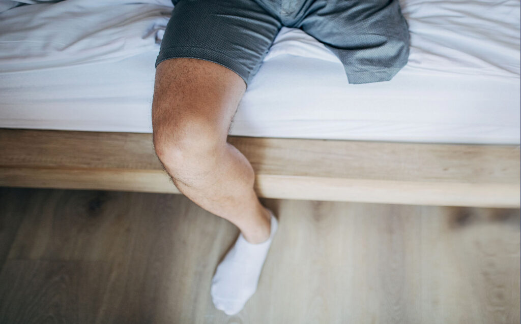 AMPUTATION Istock