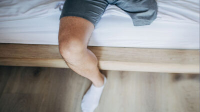 AMPUTATION Istock