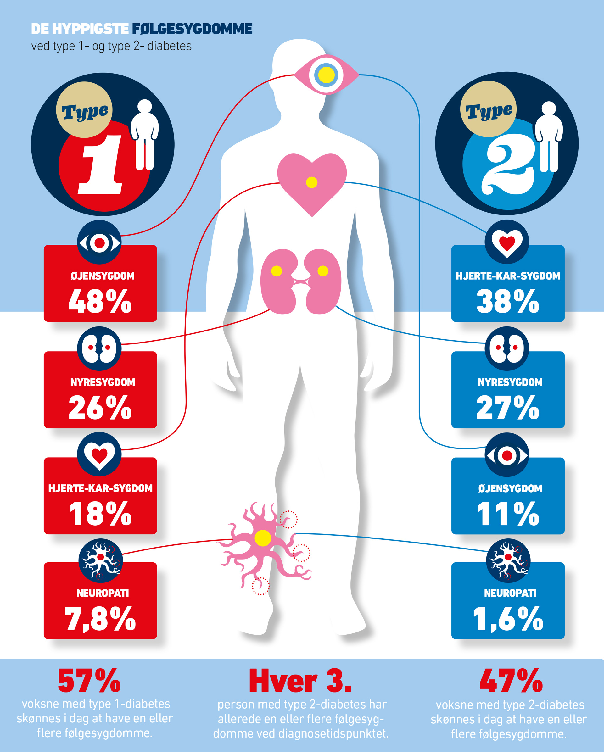 Grafik om hyppige følgesygdomme til diabetes 1 og 2